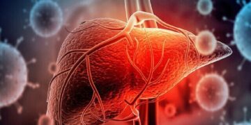 تشخیص و درمان رایگان هپاتیت در کشور